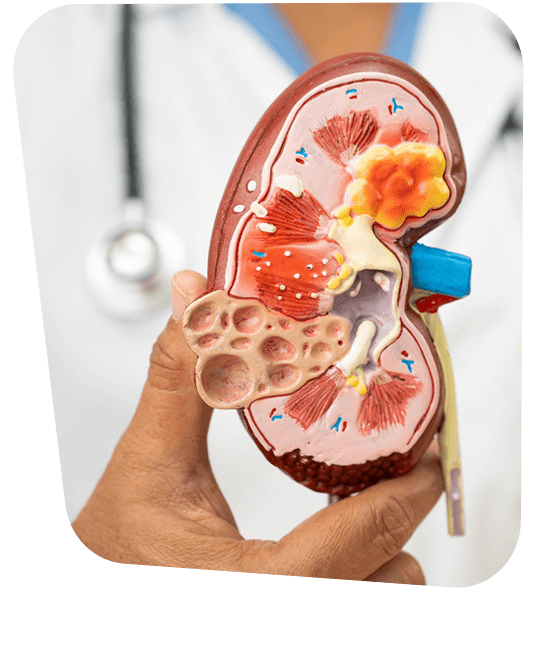 diagnostico-de-enfermedad-de-addison.png