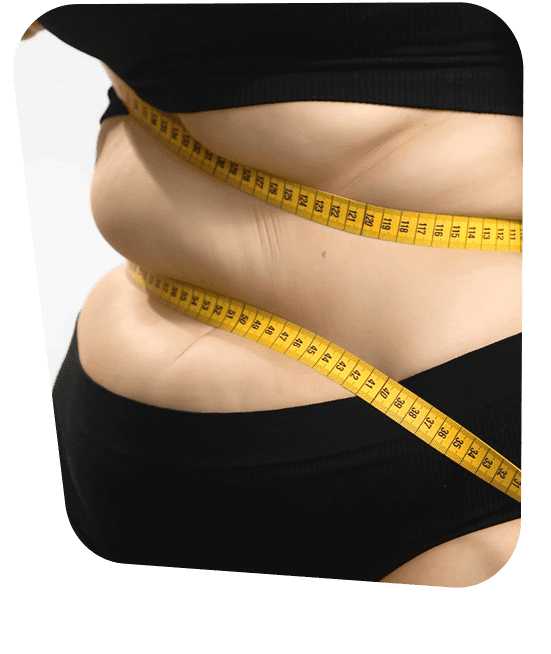 endocrinologia-y-manejo-de-la-obesidad-en-cdmx.png